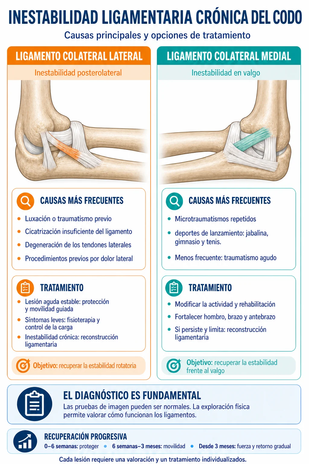 Infografía comparativa de la inestabilidad ligamentaria lateral y medial del codo