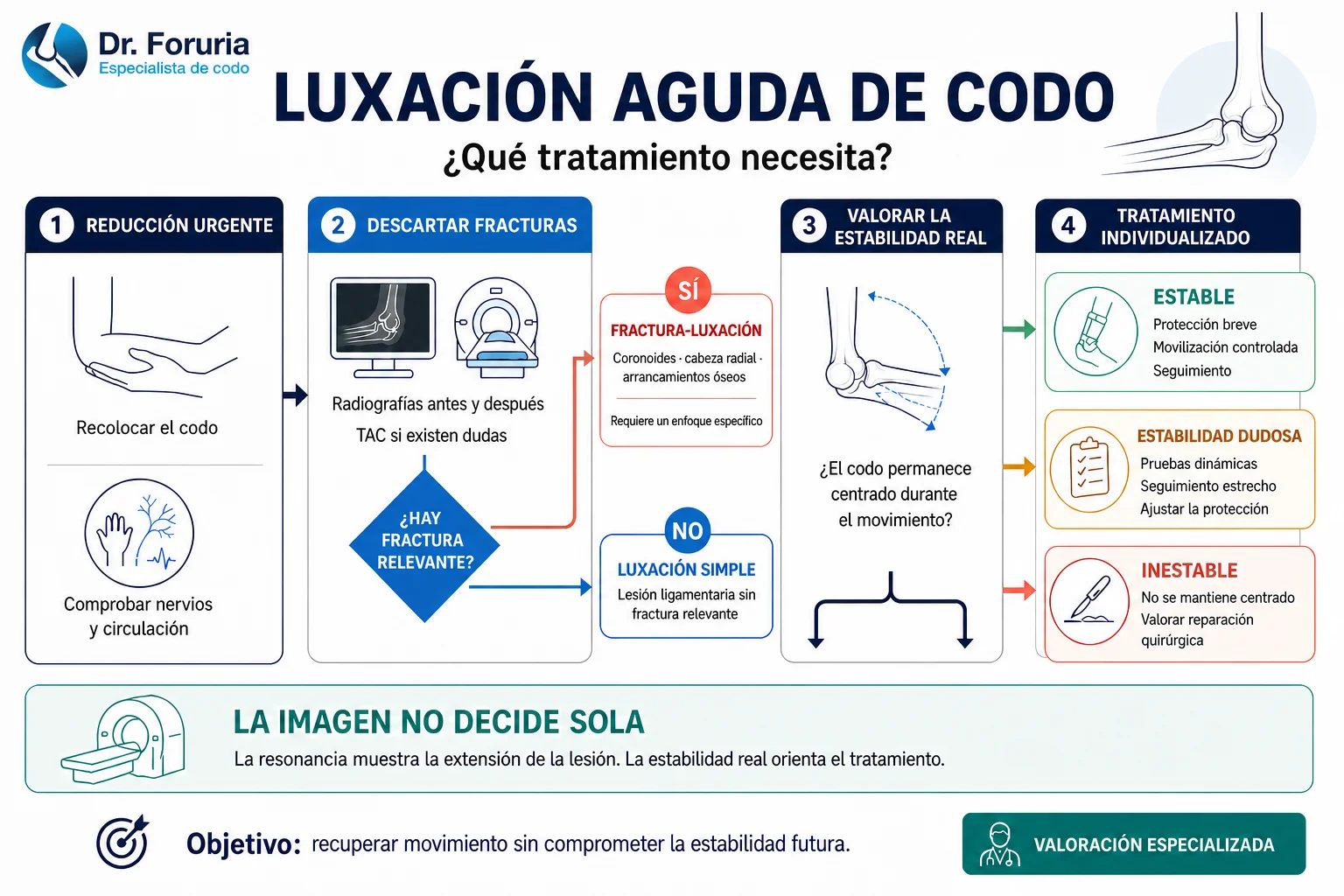 Infografía: tratamiento de la luxación aguda de codo paso a paso, desde la reducción urgente hasta el tratamiento individualizado